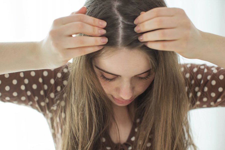 Så får du bort huvudlöss på naturlig väg